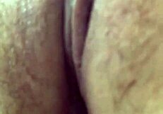 Cesur röntgenci aksiyonu kameraya yakalandı