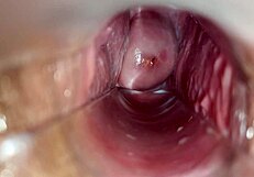 Tengok dekat-dekat orgasme dalam faraj dia