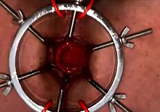 This is a hardcore anal beads insertion series part 3