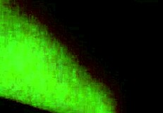 New Tattoo With Braces