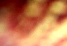 Bold Step Anal Action