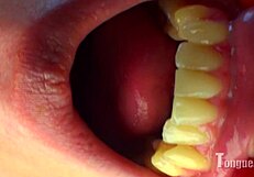 violet tongue and teeth