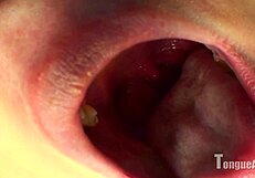 violet tongue and teeth