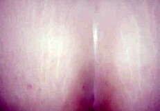 Intense action with real amateurs showcasing their big asses in hardcore scenes