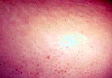 Anderson and Milena, an amateur couple.