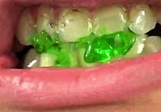 Fifi Foxx porn pearl – blowjob with teeth and gummas