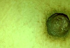 segunda parte del masaje