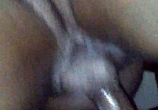 The patient receives a chocolate glaze treatment in the hospital