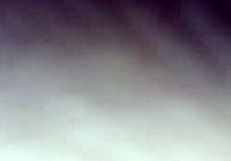 The patient receives a chocolate glaze treatment in the hospital