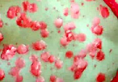 waxplay leads to ass fucking and cum filling