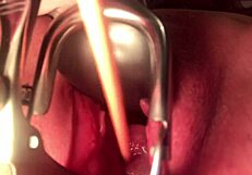 자궁경부 늘리고 소리내—얼마나 깊게 갈 수 있을까?