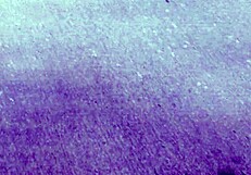 what's the deal with fanzervicas in anime?