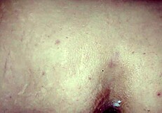 Watch This Anal Masturbation With Dilator And Medical Speculum!