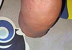 myanmar gay guy gets homemade saline injection for bigger cock