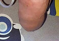 myanmar gay guy gets homemade saline injection for bigger cock