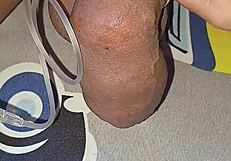 myanmar gay guy gets homemade saline injection for bigger cock