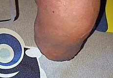 myanmar gay guy gets homemade saline injection for bigger cock