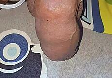 myanmar gay guy gets homemade saline injection for bigger cock