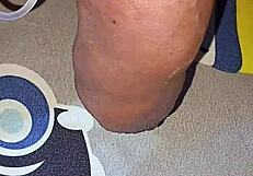 myanmar gay guy gets homemade saline injection for bigger cock