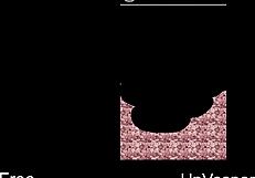 Unvesper: Erotic Anime Comedy With Shoes?