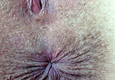 extreme closeup of wild asshole fingering for fetish fans