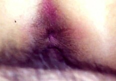 Hairy Wife's Pussy Gaping And Queefing Loudly