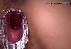 Close up and very tender on the outside, and completely bald on the inside