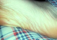 Nicoletta's bare feet ache after a long, dirty day