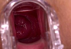 Smash Or Pass This Shaved Pussy Squirting In Homemade Fuck?