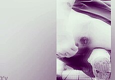 Fisting causes prolapse!