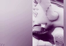 Fisting causes prolapse!