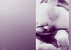 Fisting causes prolapse!