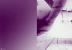 Fisting causes prolapse!