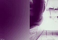 Fisting causes prolapse!