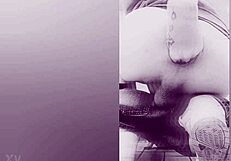 Fisting causes prolapse!