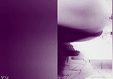 Fisting causes prolapse!