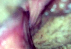 the first part of the amateur series