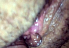 the first part of the amateur series