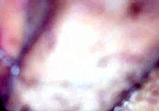 the first part of the amateur series