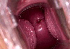 Watch Mia Austin with a speculum - it's raw and intense!