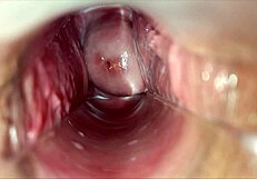 Pulsating orgasm inside vagina