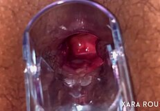 Anal vision speculum gaping that huge ass!