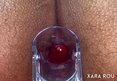 Anal vision speculum gaping that huge ass!