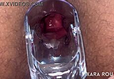 Anal vision speculum gaping that huge ass!