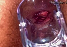 Anal vision speculum gaping that huge ass!