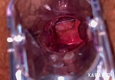 Anal vision speculum gaping that huge ass!