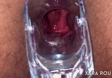 Anal vision speculum gaping that huge ass!