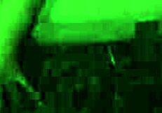 Sadomasochism Electro Castigation Involves Intense Electrical Stimulation And Painful Discipline