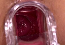 sara luvv usin a speculum