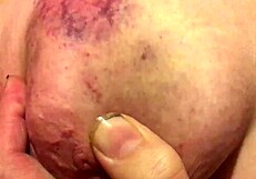 I begged my dom to film him bruising and messing my chubby squirting whore body with toys